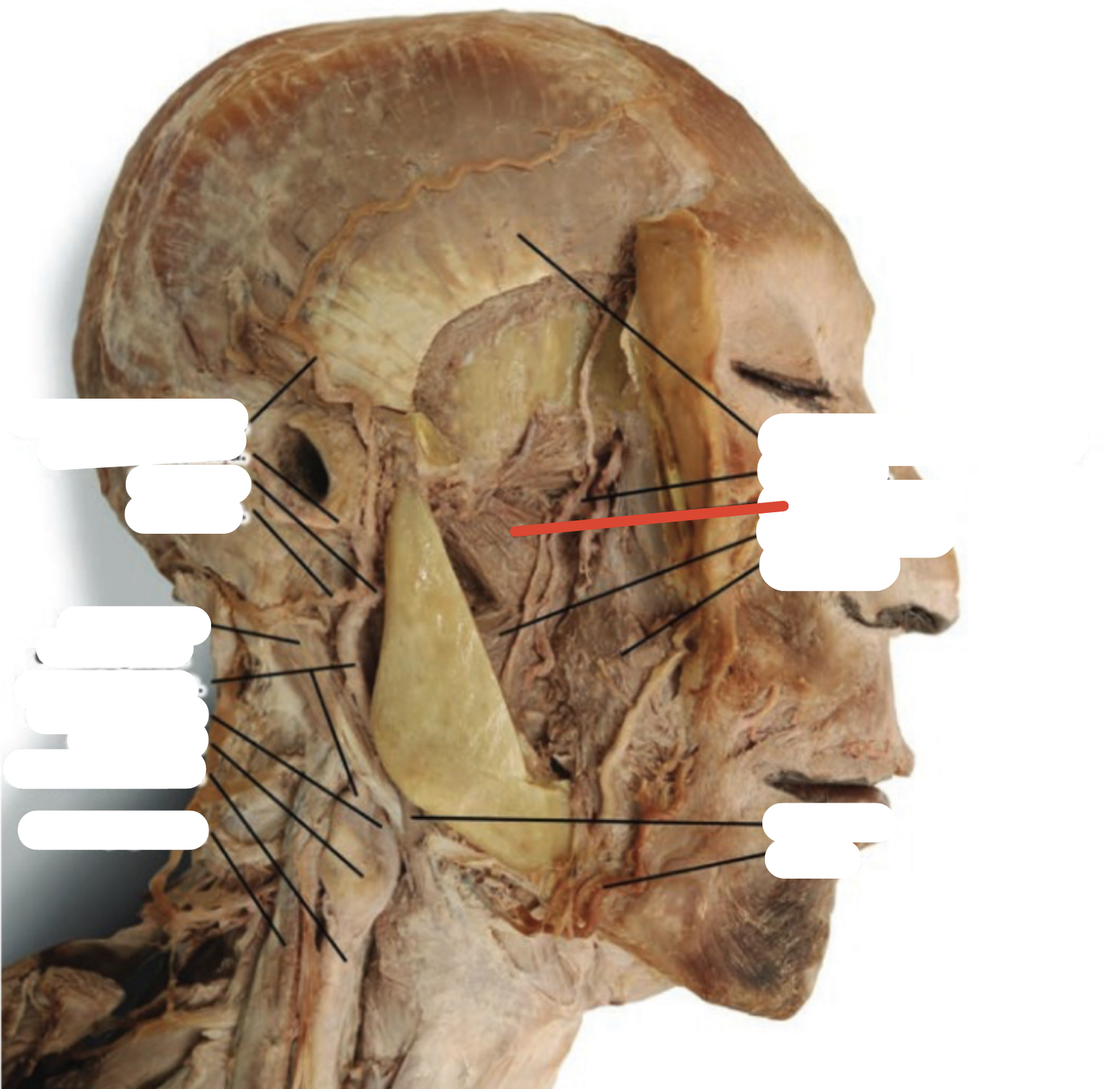 Identify the structure (red line)