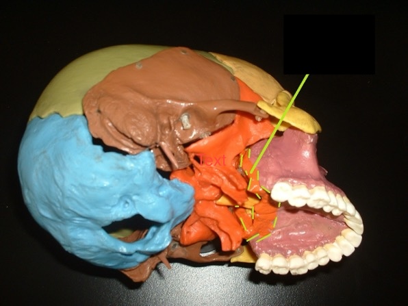 <p>a boxy “U”-shaped bone behind the palatine process. The back of the roof of the mouth.</p>