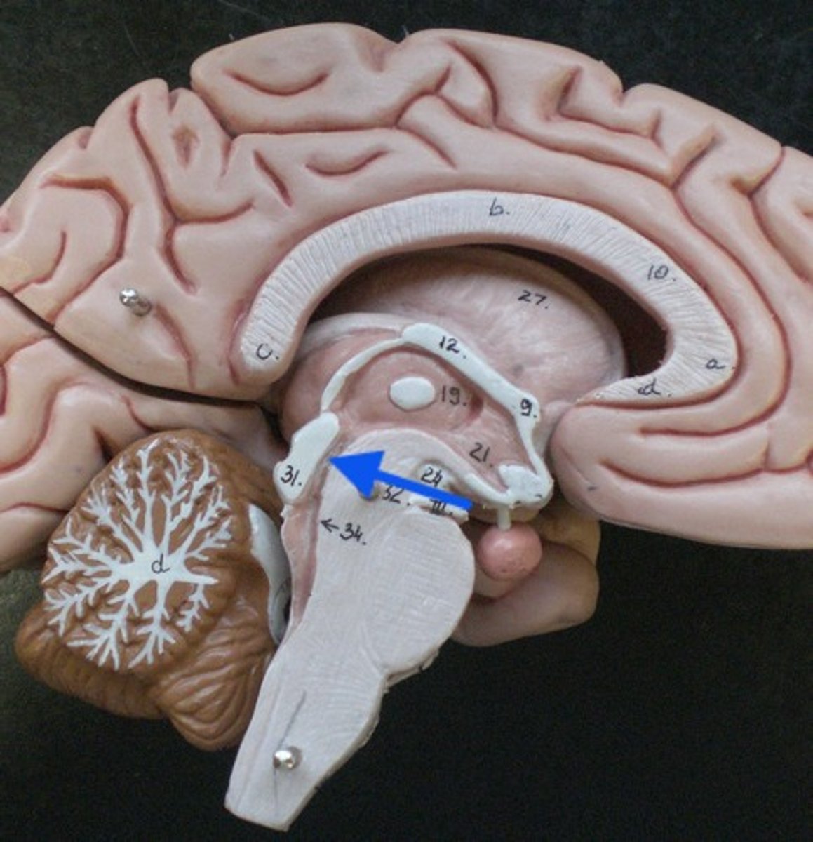 <p>Narrow passageway for cerebrospinal fluid.</p>