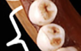 <p>premolars </p>