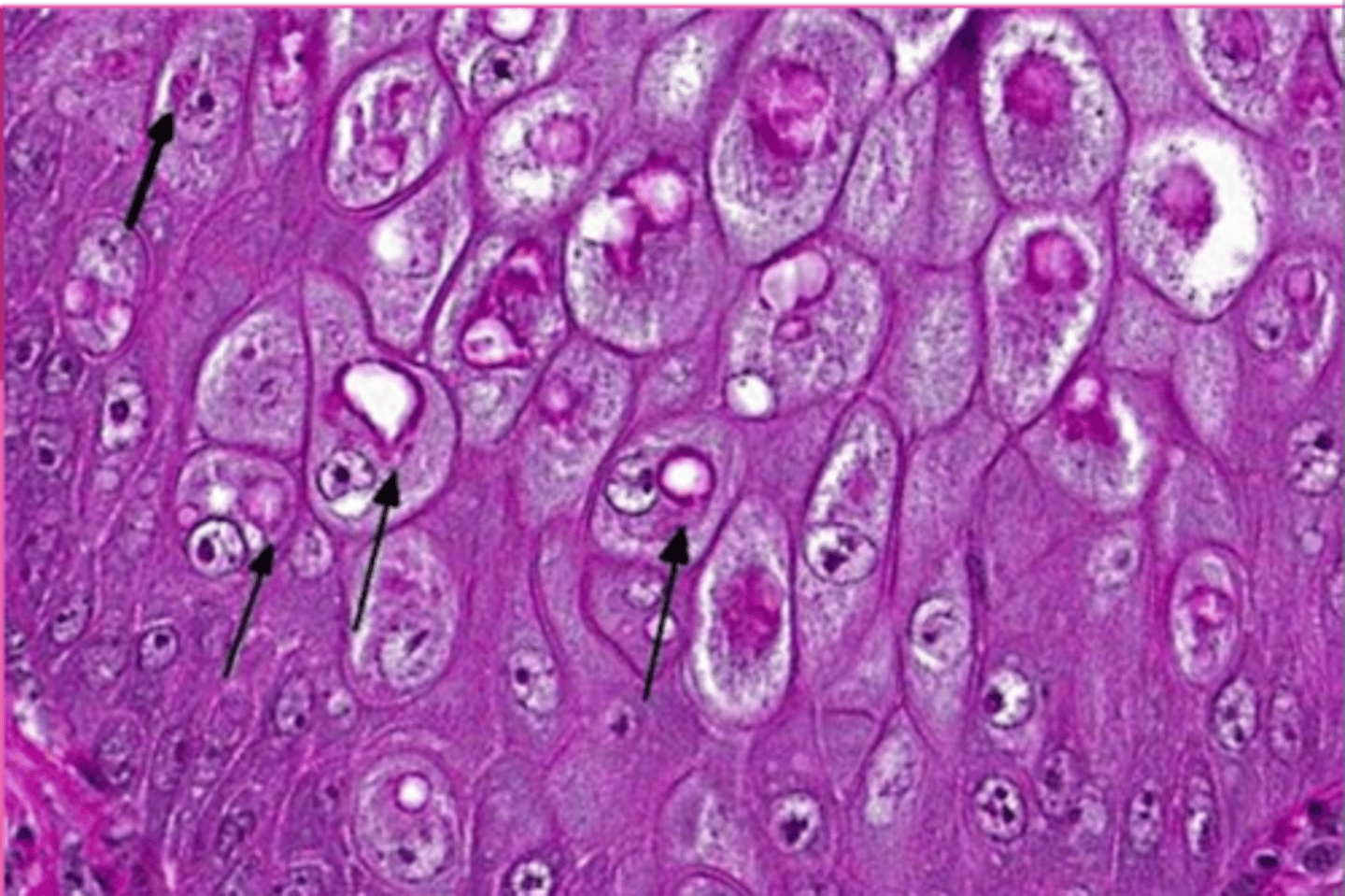<p>What is this?</p><p>(Options are like, glycogen, lipid, viral, iron inclusions.... options are all the inclusions a cell can have)</p>