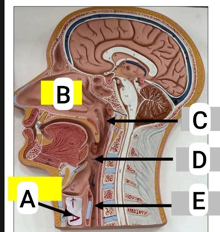 <p>Identify the following and then answer these questions</p><p></p><ul><li><p>Where does this tube begin ?</p></li></ul><p></p><ul><li><p>Level of termination of this tube</p></li></ul><p></p><ul><li><p>continuation of this tube?</p></li></ul><p></p>