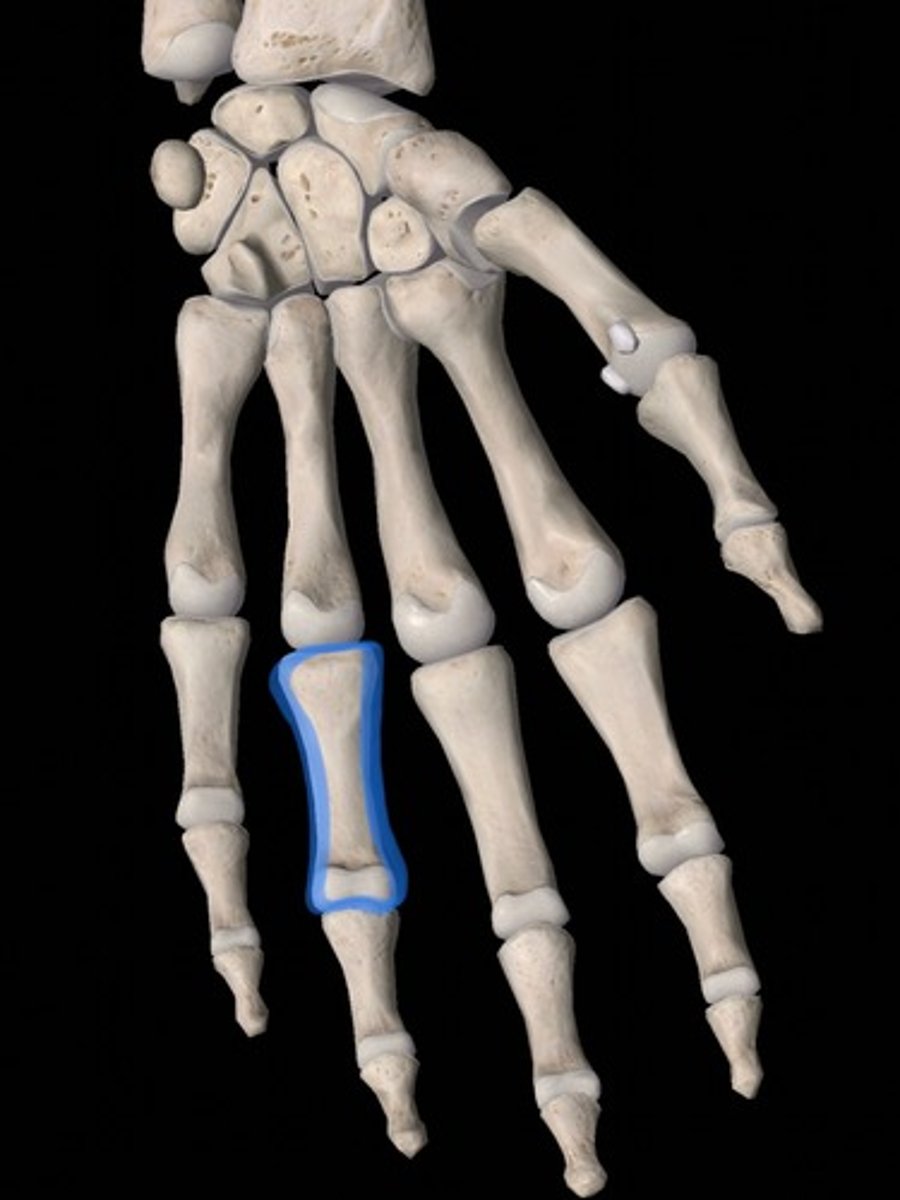 <p>bone</p>