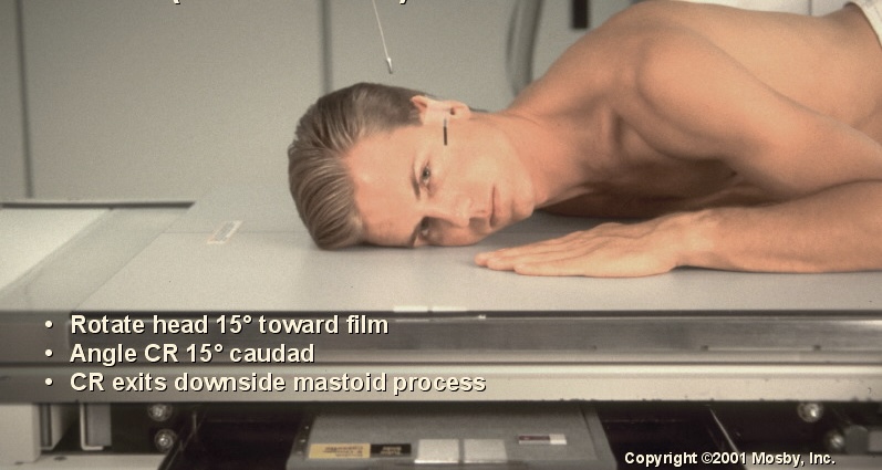 <p>What position is this?</p>