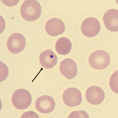 <p>What is the inclusion in this erythrocyte?</p>