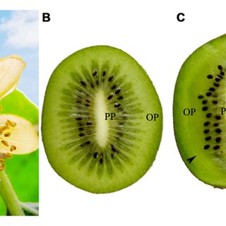 <p>Identify the ovule placentation.</p>