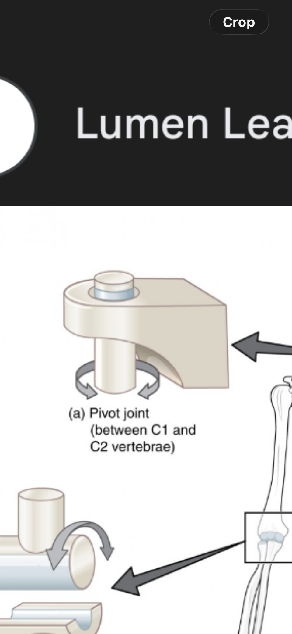 <p>Pivot Joint</p>