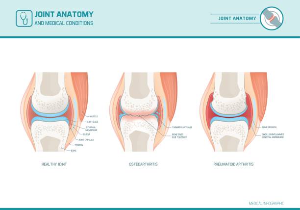 <p>The connection between two bones — the areas where two or more bones meet</p>