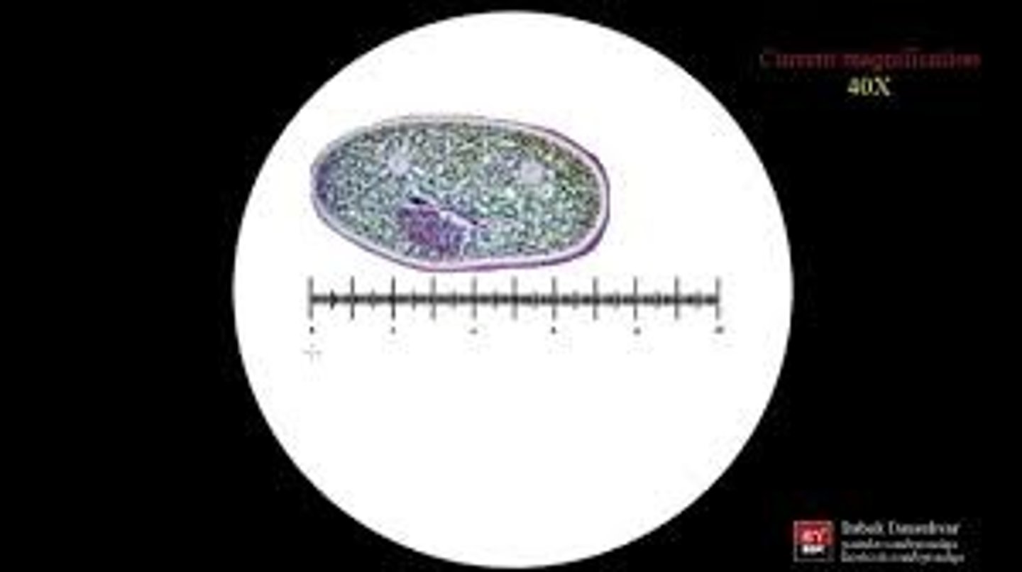 <p>Each bar is equal to 10 um since you are using the 10X objective</p><p>3 (10 um) X 2 (10 um) = 30 um X 20 um</p>