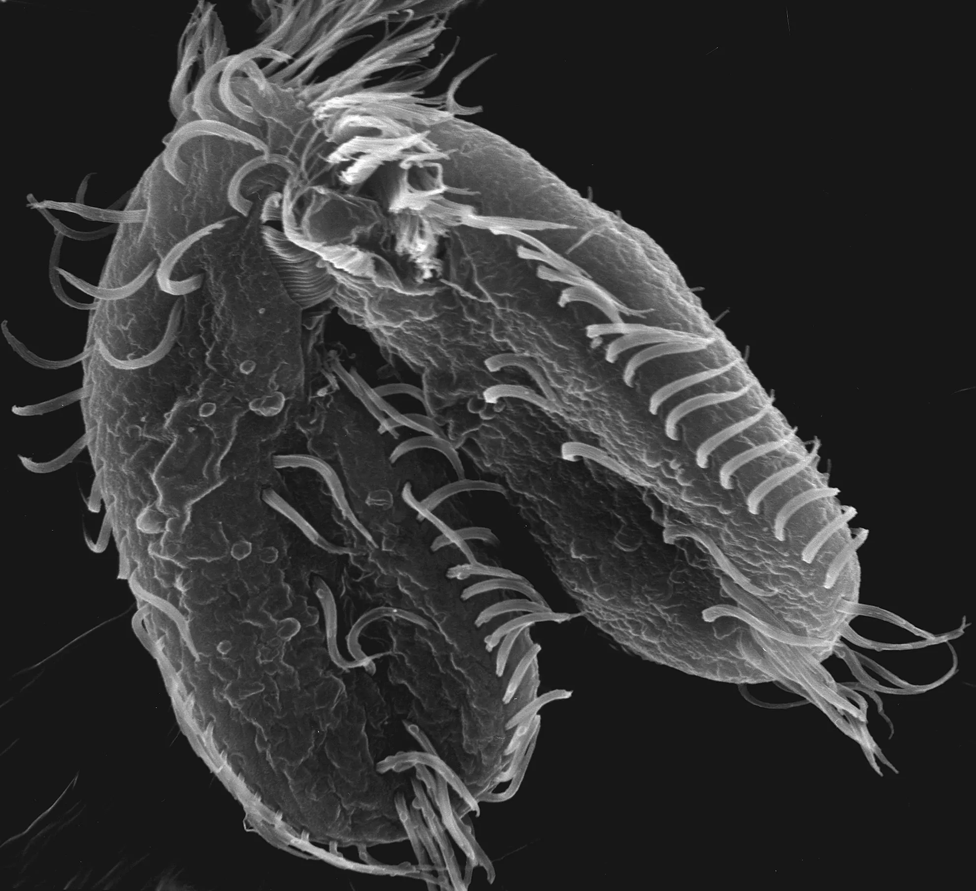 <p>-protozoa oxytricha genome is full of transposons</p><p>-germline: chromosome (has transposons)</p><p>-Germline= <span>Changes in the DNA that occur in the reproductive cells (sperm or egg) and can be passed on to offspring</span></p><p>-somatic chromosome (has no transposons)</p><ul><li><p><span>Somatic=Changes in the DNA that occur in any other cells in the body (non-reproductive cells) and are not passed on to offspring</span></p></li></ul><p>-during development, transposon genes highly expressed —&gt; flood cell with transposase, which shreds the genome</p><ul><li><p>genome gets reformed as somatic chromosome</p></li><li><p>experiment suggests transposons now essential for reproduction</p></li></ul><p></p>