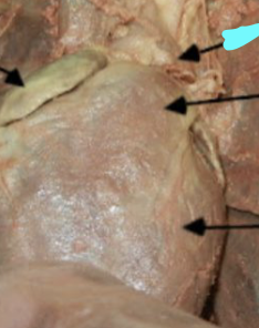 <p><strong>blue line</strong></p>