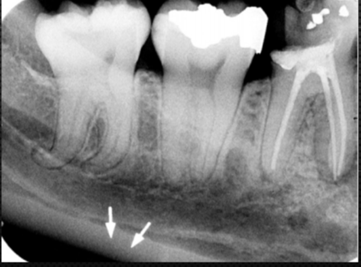 <p>Identify the structure</p>