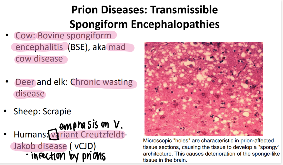 <p>transmissible spongiform encephalitis (prion disease) </p>