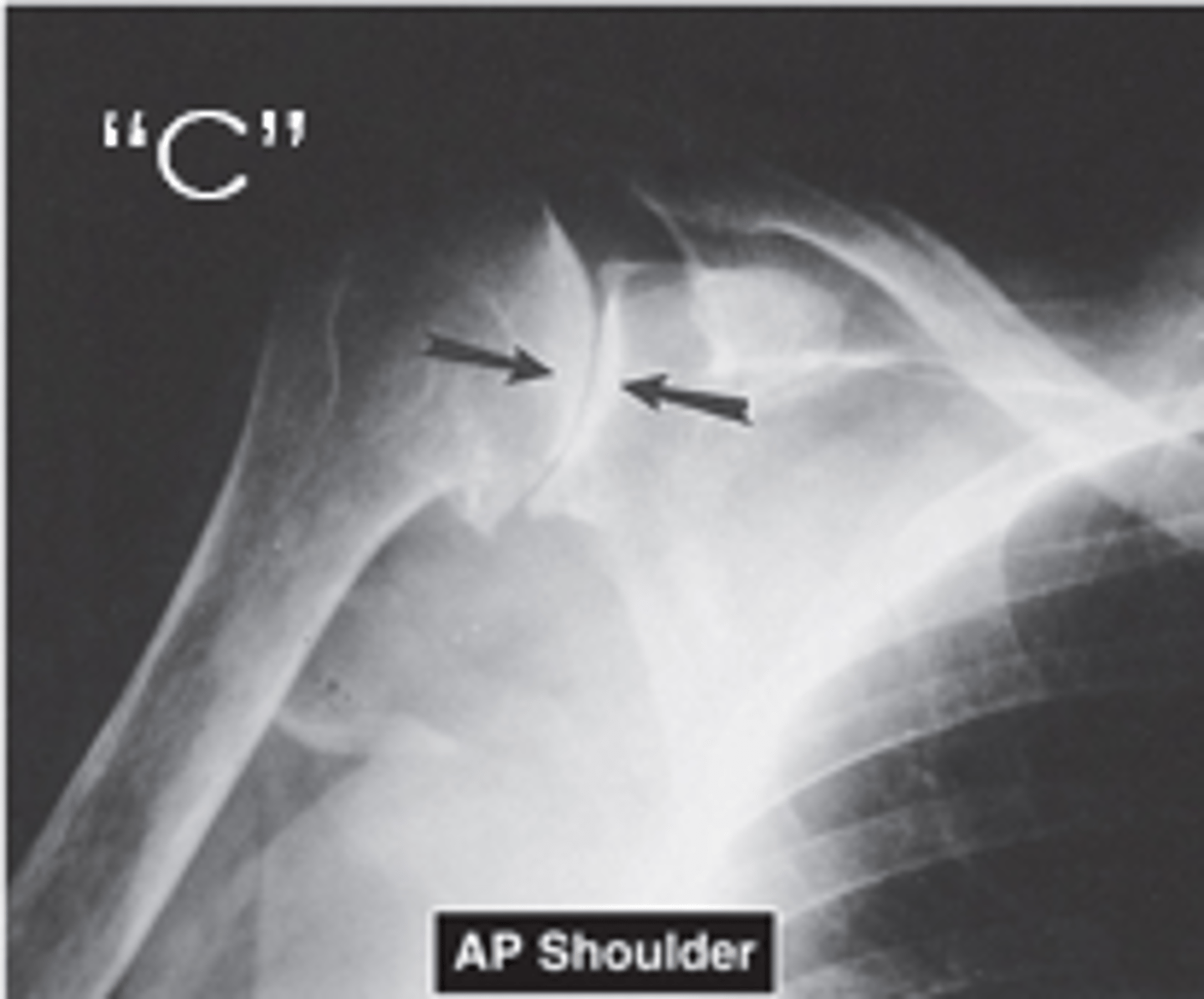 <p>Joint Space Width</p><p>- Well preserved joint spaces imply normal cartilage or disk thickness</p><p>Subchondral Bone</p><p>- Smooth surface</p><p>Epiphyseal Plates</p><p>- Normal size relative to epiphysis and skeletal age</p>