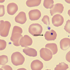 <p>What is the inclusion in this erythrocyte?</p>