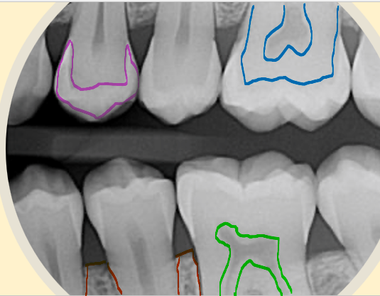 <p>what is the structure highlighted in green?</p>