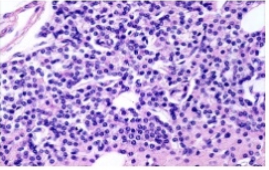<p>Parathyroid Gland</p>