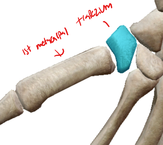 <p>the joint between the first metacarpal and the trapezium</p>