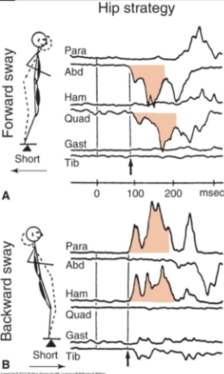 <p>Order of MA (but kinda at same time)</p><p>1. abdominals muscles</p><p>2. quadriceps</p><p>Think: MA in direction of sway</p>