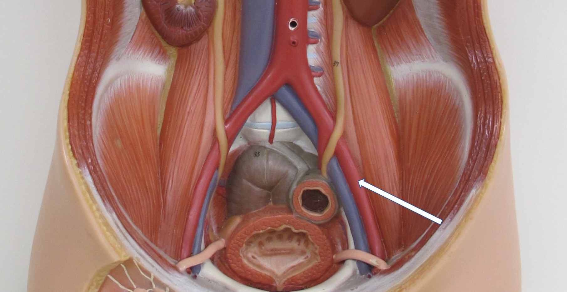 <p>arterie</p>