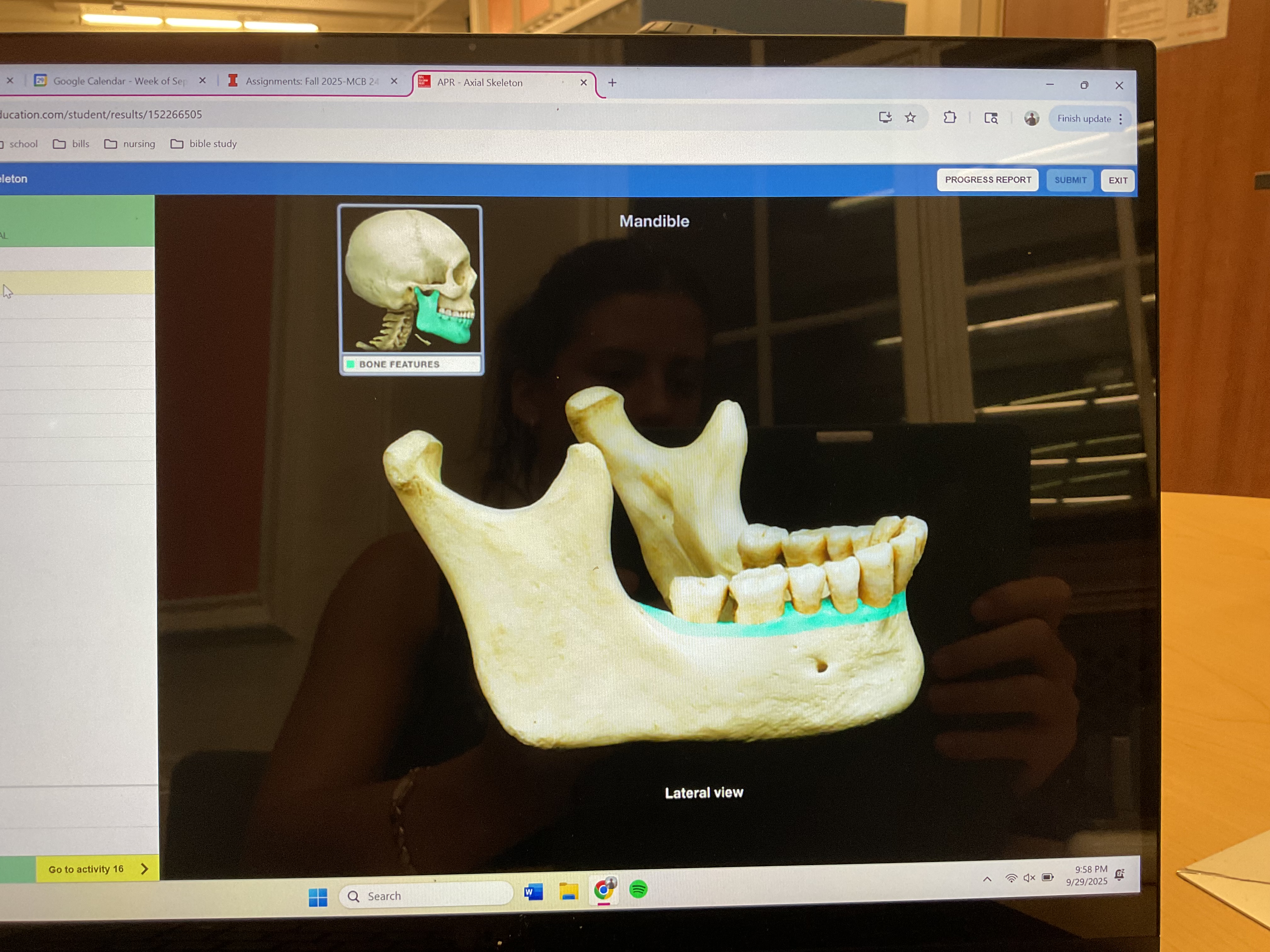 <p>Alveolar process of mandible</p>