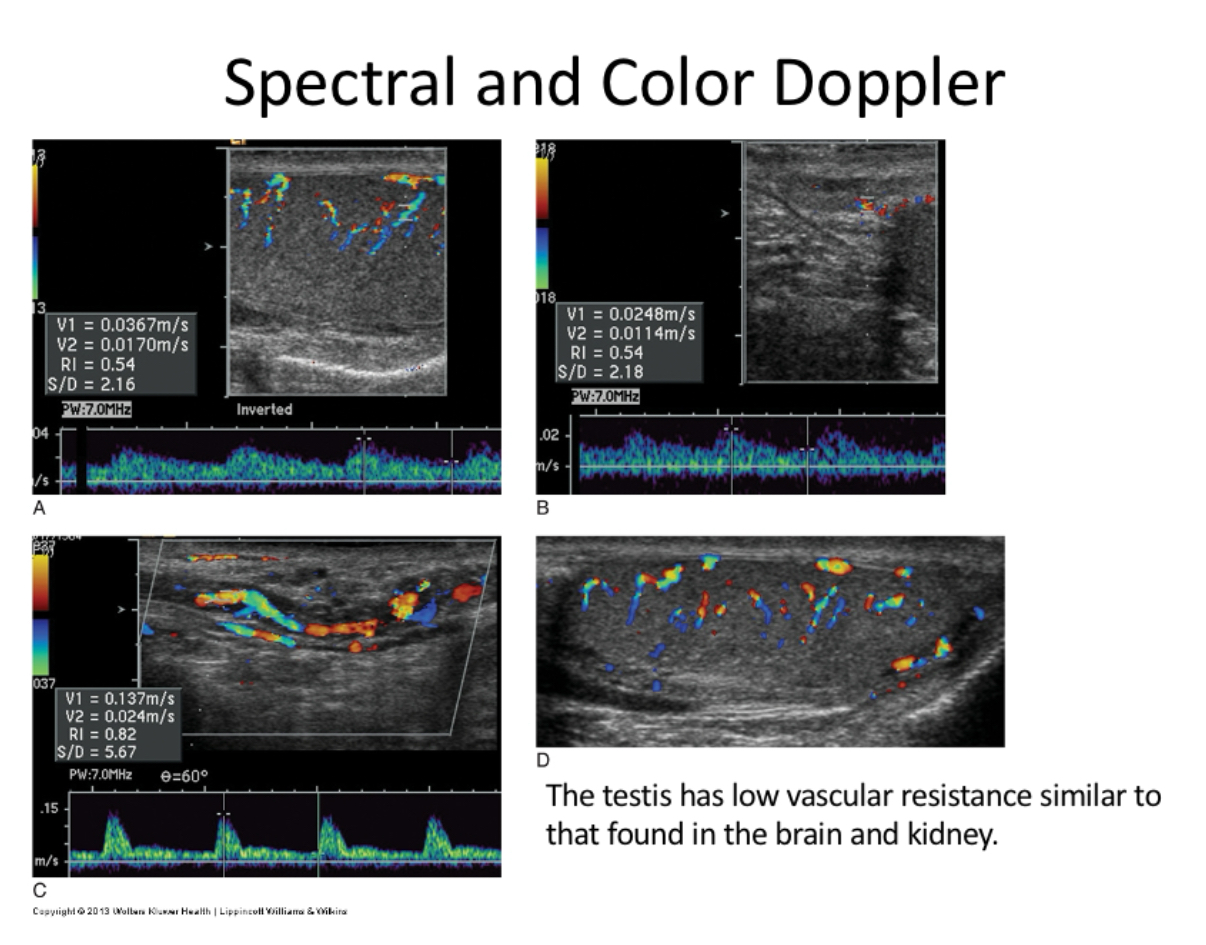 <p>What originate from aorta feeds testis and have low resistance flow?</p>