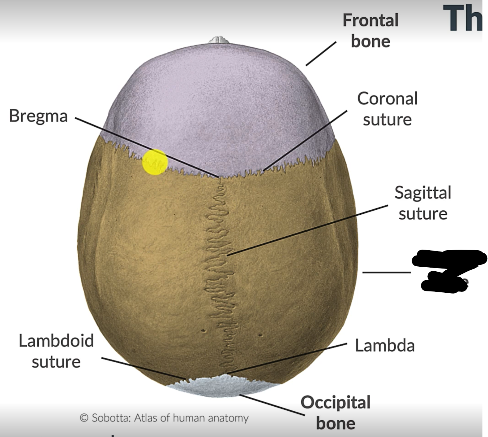 term image