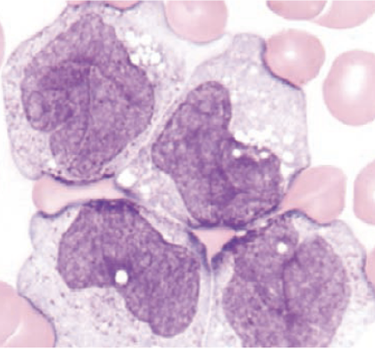 <p>what cell predominates&nbsp;in M5b?</p>
