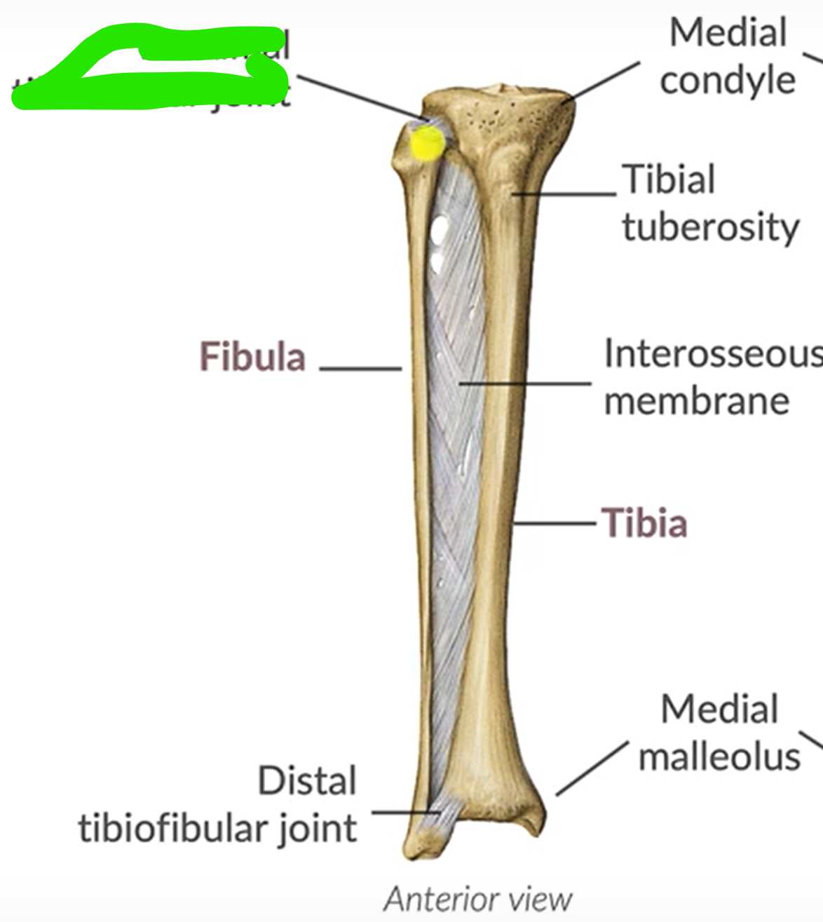 term image
