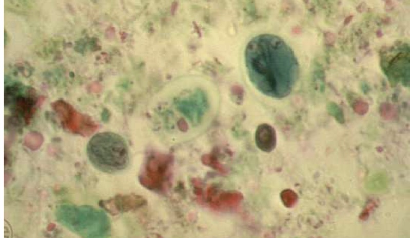 <p>Identify: Protozoa</p>