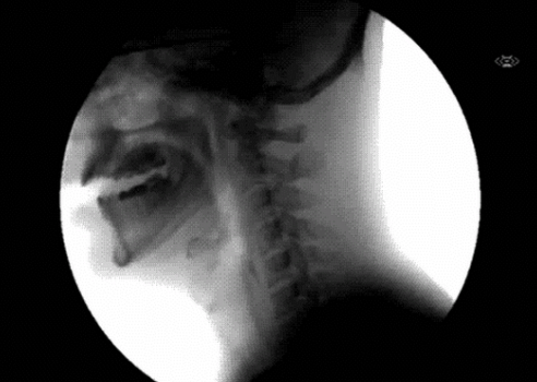 <p>__________ begins as a voluntary action</p><ul><li><p>sets off reflexive opening/closing of openings (ex. nasal cavity)</p></li><li><p>past mid-esophagus: completely <strong>involuntary (under autonomic control)</strong></p></li></ul><p></p>