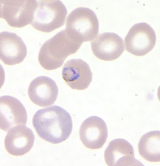 <p>Dr. Vicente Y. Belizario Jr.</p>