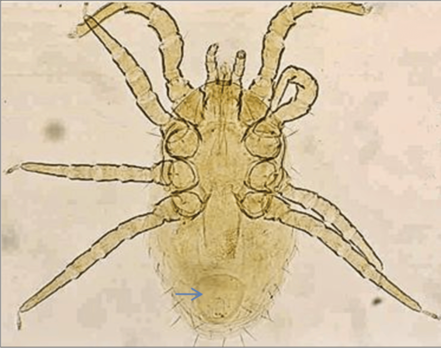 <p>Found on a chicken with severe anaemia and papules which are intensely pruritic. What parasite is this?</p>