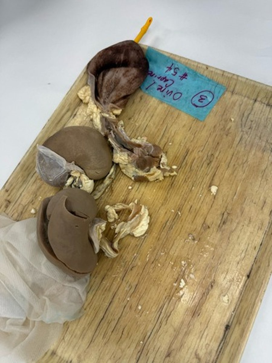 <p>Provide morphological diagnosis</p>