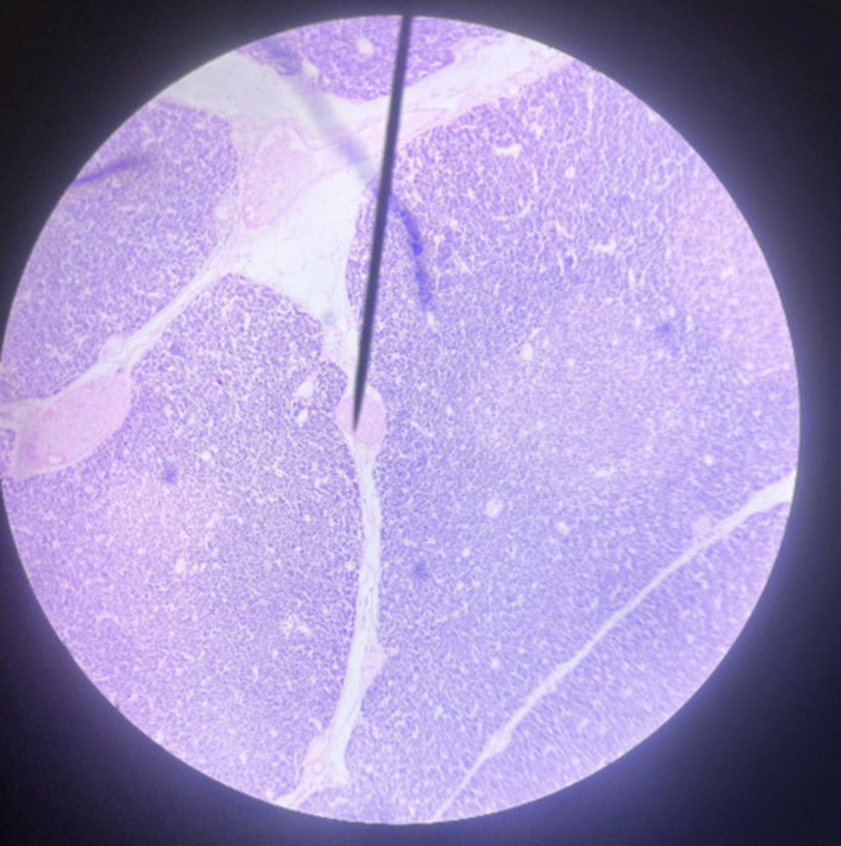 <p>what hormone does this gland secrete?</p>