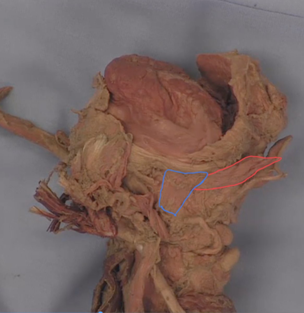 <p>identify structure outlined in red</p>