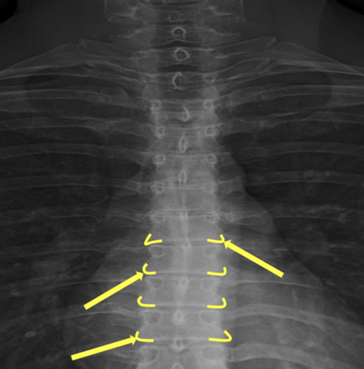 <p>What are the yellow arrows pointing to?</p>