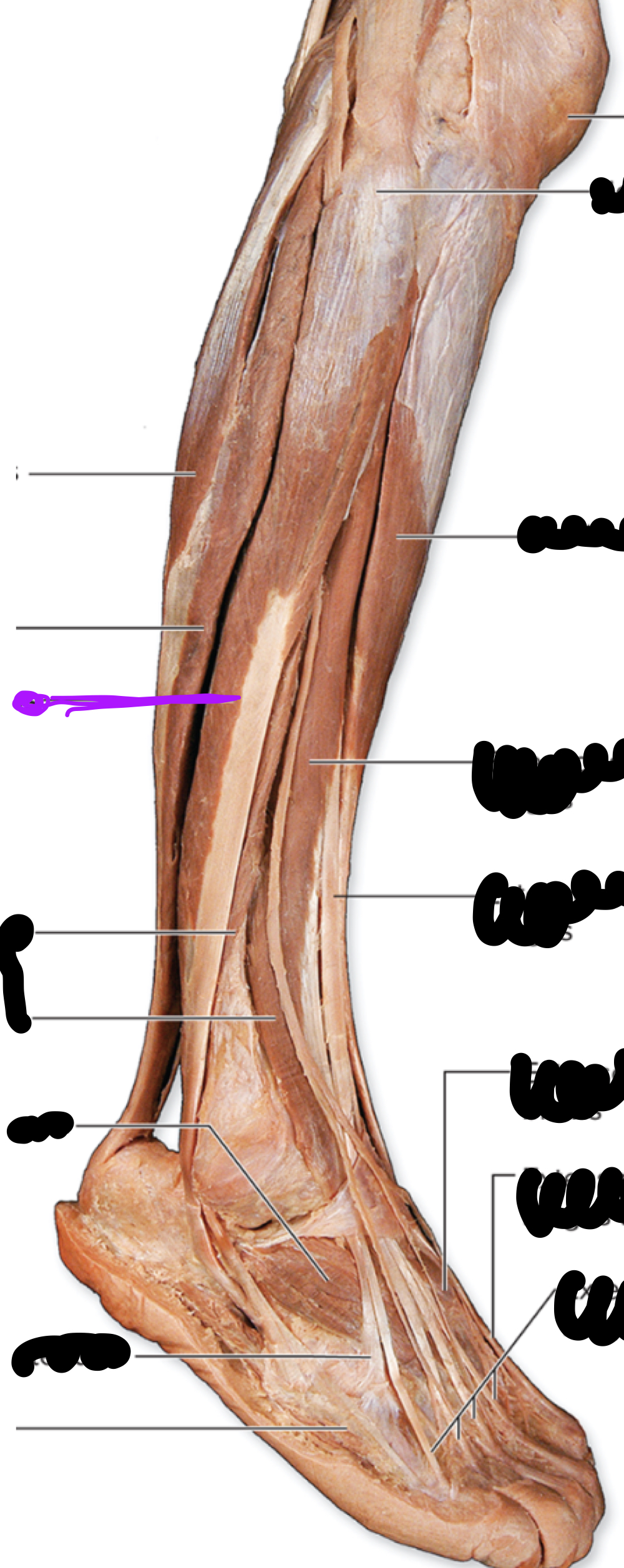 <p>Innervation?</p>
