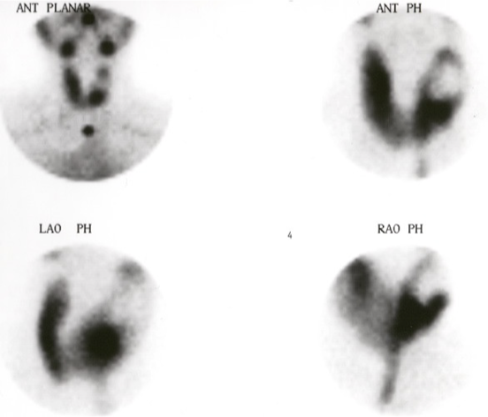 <p>What is your impression of this scan?</p>