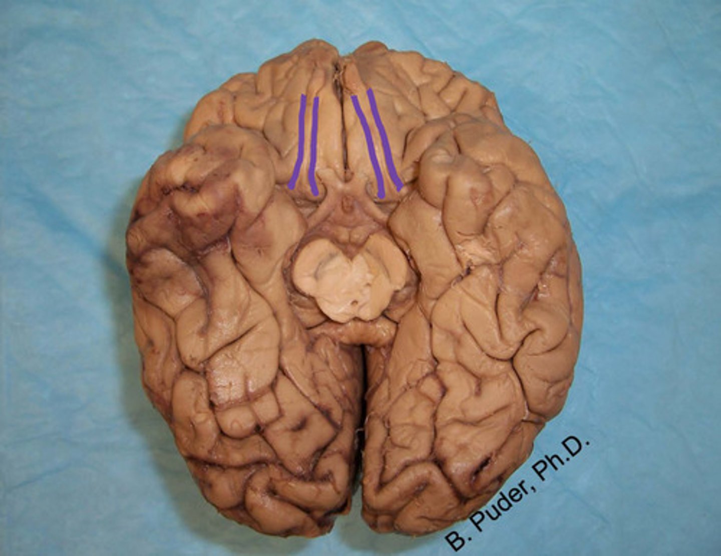 <p>label the structure</p>