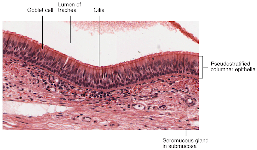 <p>appears layered but is actually only one layer on the basement membrane </p><p>nonuniform cells </p><p>columnar and basal cells </p><p>usually ciliated </p><p>ex: respiratory tract </p>