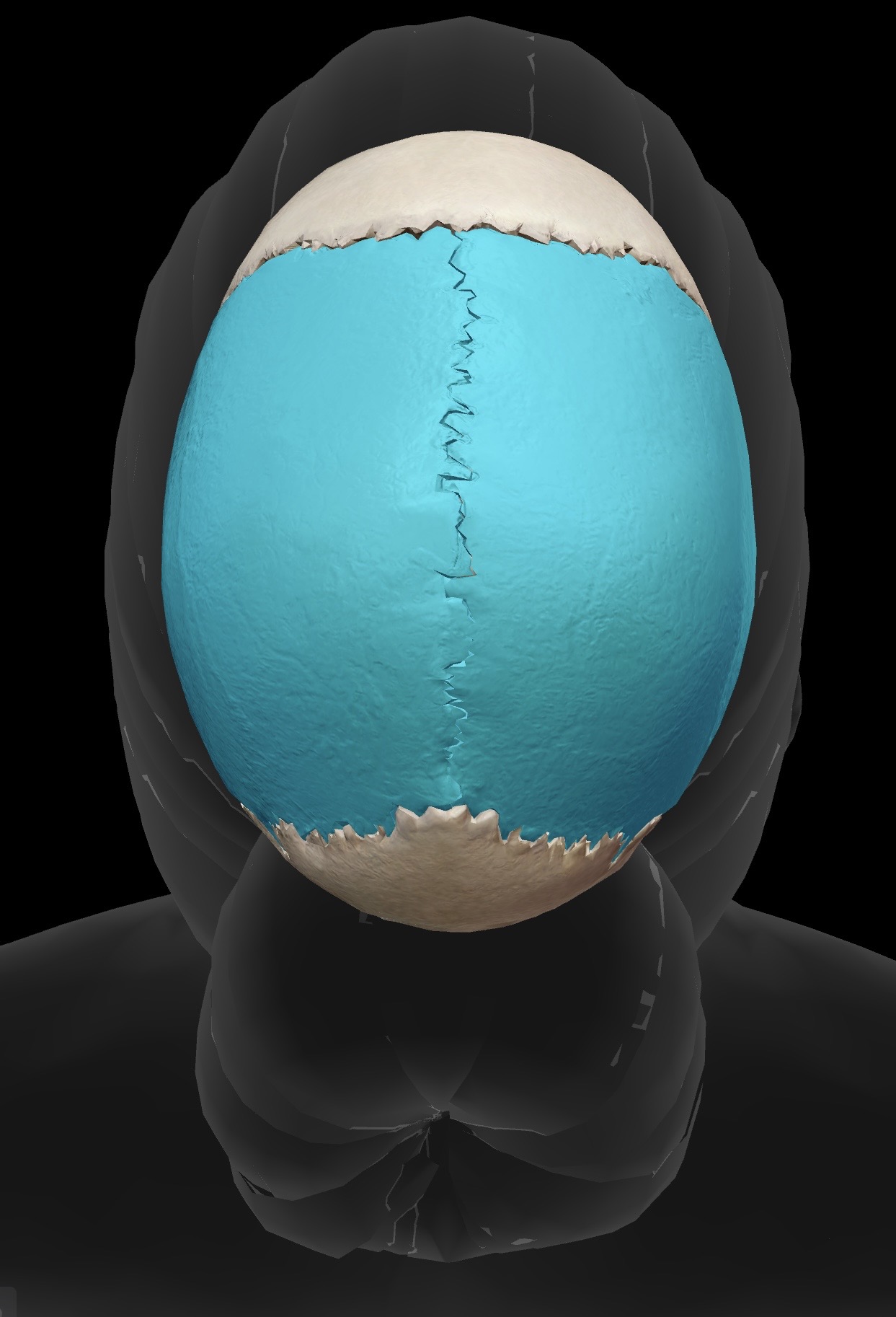 term image