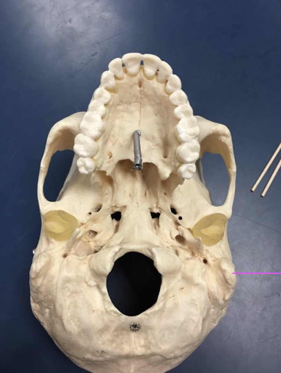 <p>What bone marking is this?</p>