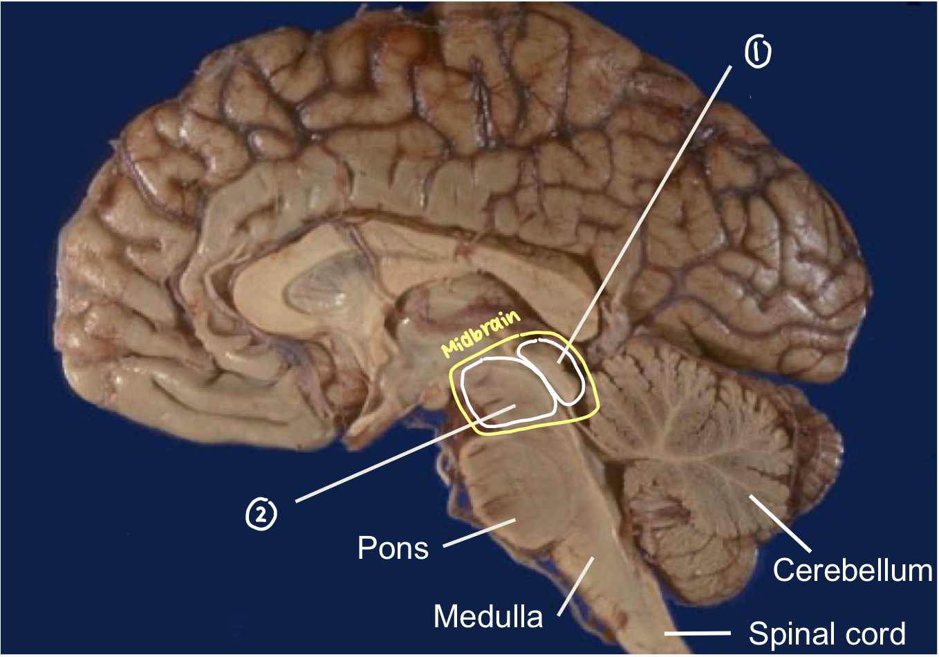 <p>Major components of Midbrain</p>