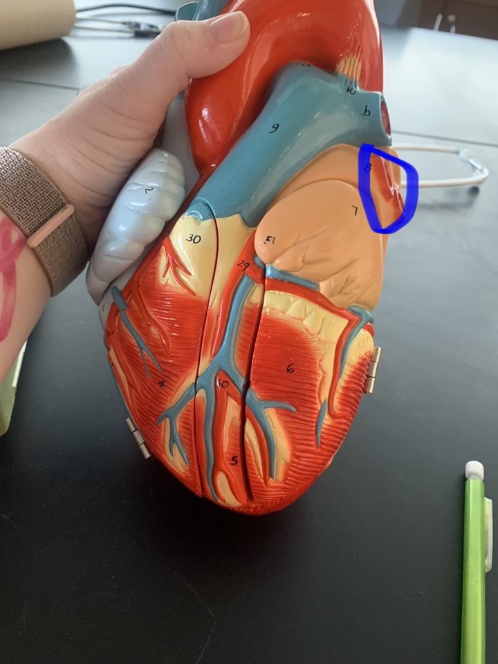Name the heart structure.