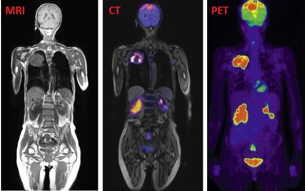 <ul><li><p>Radiography → xray, mammography </p></li><li><p>Ultrasound </p></li><li><p>Computed tomography (CT scan) </p></li><li><p>Magnetic resonance imaging (MRI)</p></li><li><p>Positron emission tomography (PET) </p></li></ul><p></p>