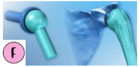 <p>Found on any shoulder, this joint is a freely moving joint that can rotate on any axis (hip, and shoulder).</p>