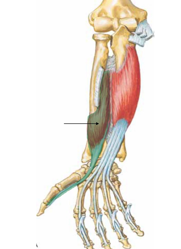<p>What muscle is indicated?</p>