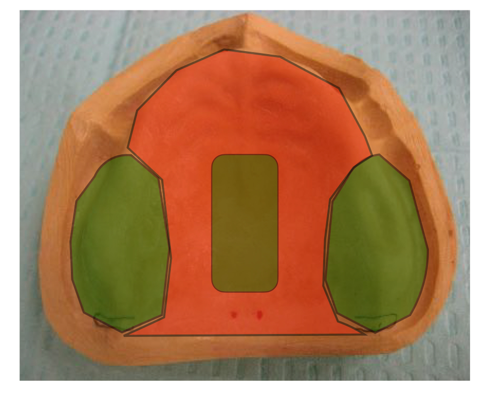 <p>what areas are shaded in green?</p>