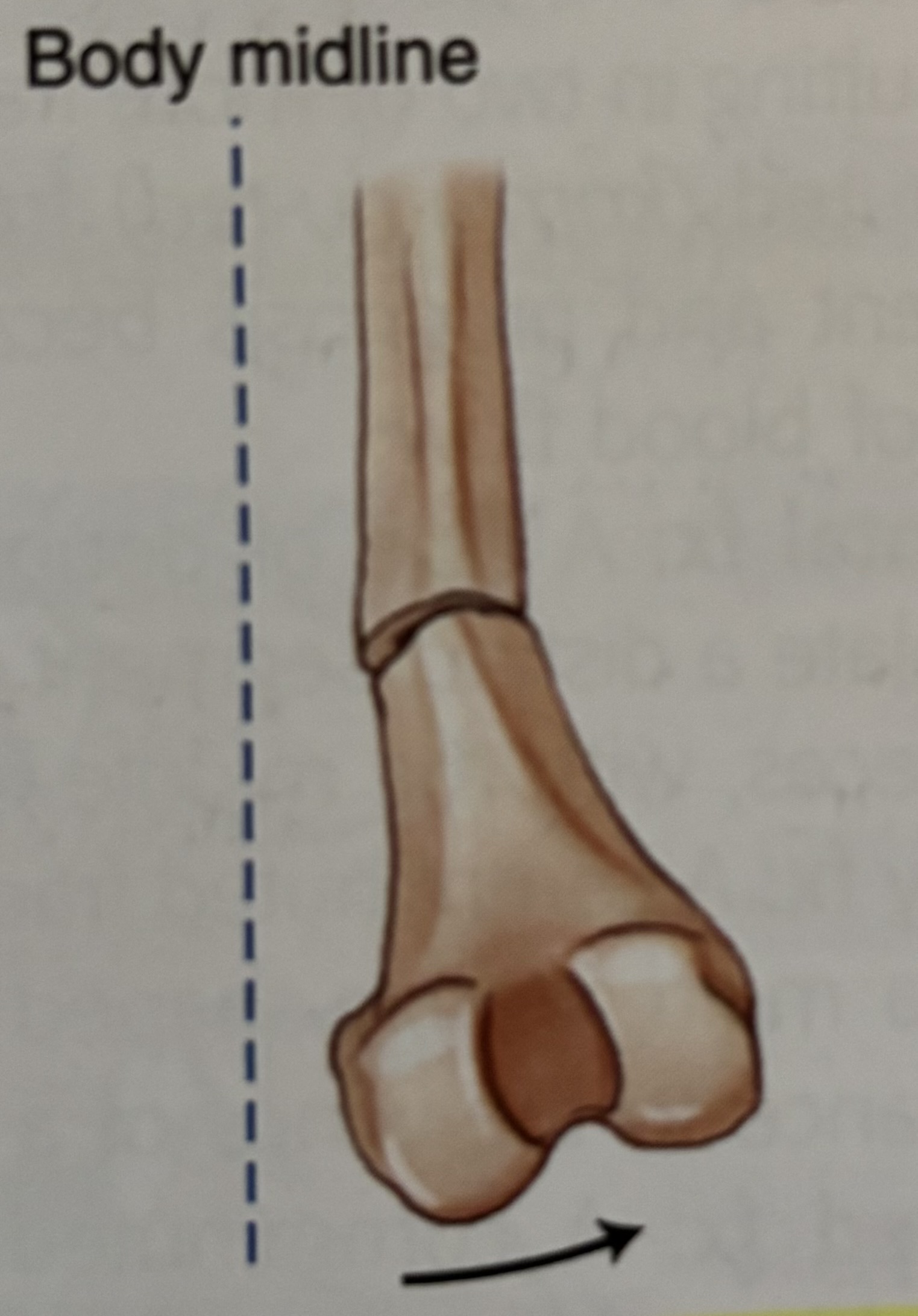 <p>What type of fracture is this?</p>